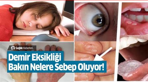 Sızıntı Nedenleri Nelerdir?